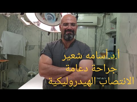 شاهد عملية دعامة العضو الذكرى الهيدروليكية القابلة للنفخ لعلاج ضعف الانتصاب ـ الخبير أ.د. أسامه شعير