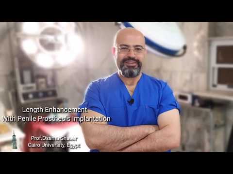 Penile Length enhancement with Penile Prosthesis Implantation