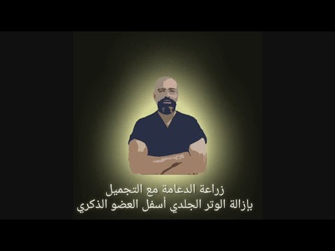 دعامة العضو الذكري مع الإطالة و التجميل - ۳ FHD