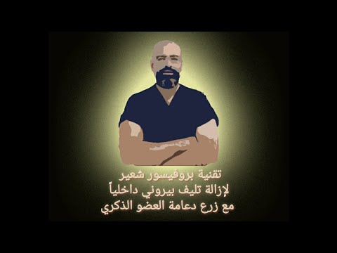 تقنية بروفيسور شعير لإزالة تليف #بيروني:فتح علمي جديد لإزالة بيروني داخلياً مع #دعامة_العضو_الذكرى