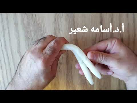 دعامة العضو الذكري الصلبة Malleable Penile Implant