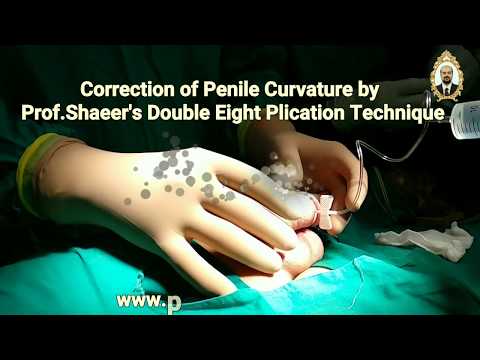 #Penile_curvature surgery/ #penile_deviation surgery: New Double Eight Plication Technique